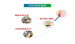 我院输血科成功在多科室开展PRP治疗技术