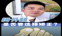 拇外翻是否必须要进行矫正？