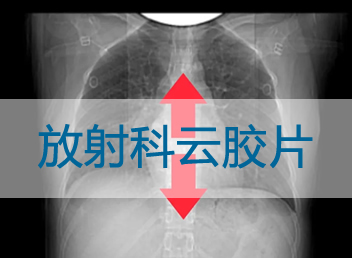 四川现代医院放射科云胶片服务上线