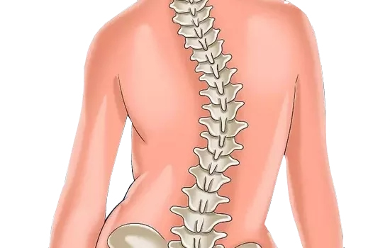 危害青少年身心健康的疾病脊柱侧弯