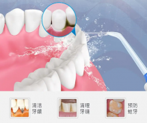 成人多久洁一次牙比较合适