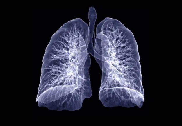 肺部变白是什么原因？