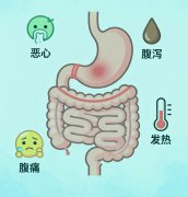 针对这几种腹泻需要及时就医